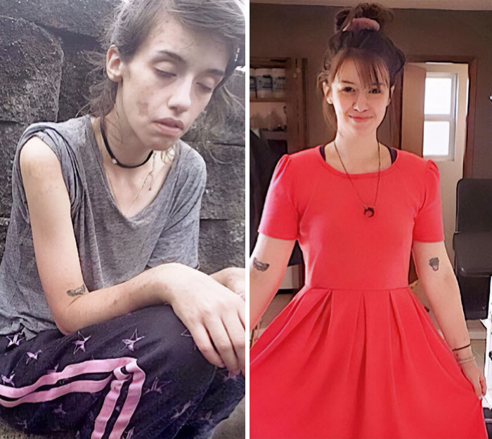 31 Heartwarming Before And After Images That Are So Wholesome !